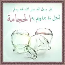 حجامة للنساء