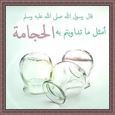 حجامة للنساء